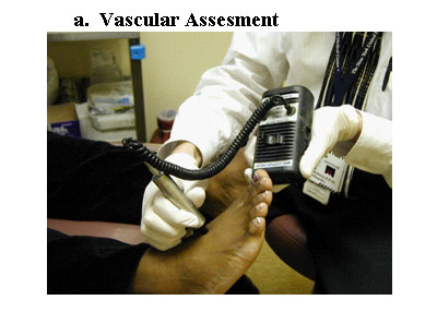 vascular assessment machine 